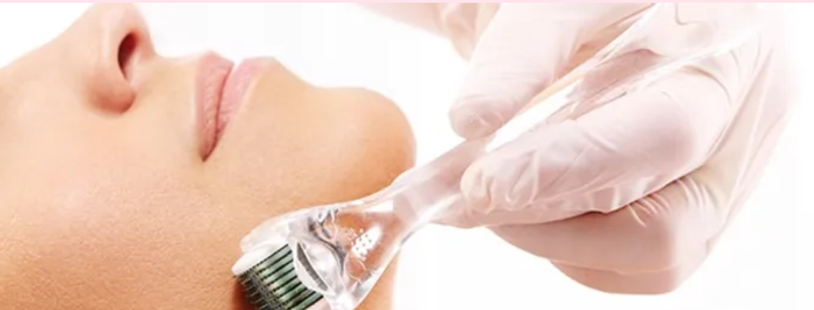 microneedling almere