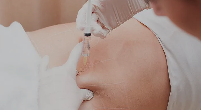 fat dissolving injection